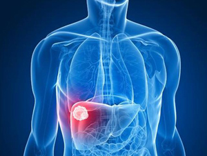 Best Gastroenterologist in Guntur, Best Paediatrics Hospital in Guntur, Asthma Treatment in Guntur, Low Birth Weight Treatment in Guntur, Treatment for Sepsis in Kids, Best COPD Treatment in Guntur, Vertical Sleeve Gastrectomy Treatment in Guntur, Best Bariatric Surgery Treatment in Guntur, Mini Gastric Bypass Treatment, Roux-En-Y Gastric Bypass Treatment in Guntur, Best Obesity Surgeon in Guntur, Weight Loss Surgery Treatment in Guntur